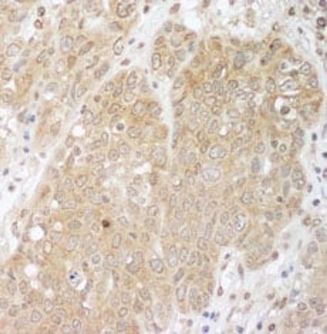 Detection of human Cbl-b by immunohistochemistry.