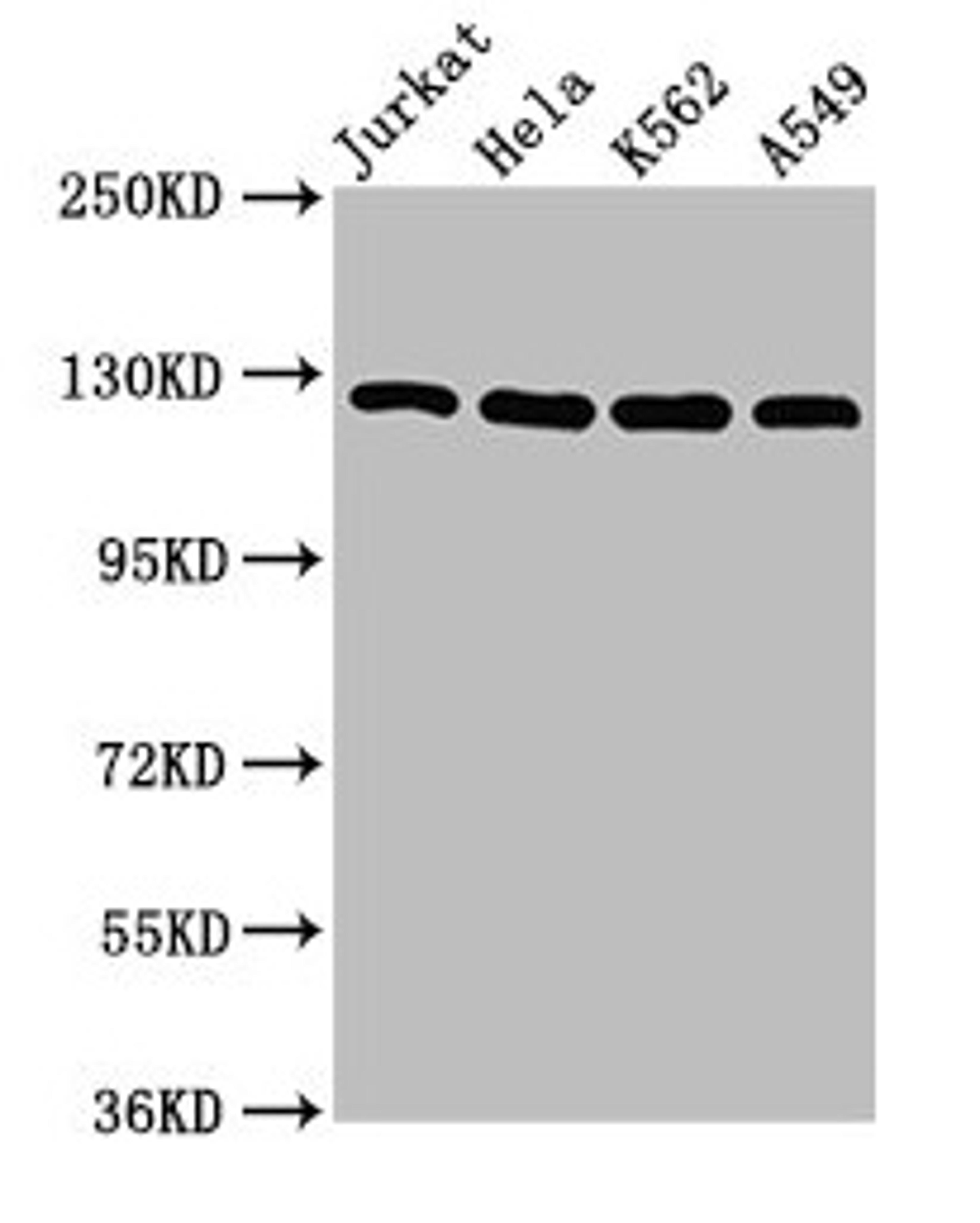 Western Blot. Positive WB detected in: Jurkat whole cell lysate, Hela whole cell lysate, K562 whole cell lysate, A549 whole cell lysate. All lanes: POLD1 antibody at 5µg/ml. Secondary. Goat polyclonal to rabbit IgG at 1/50000 dilution. Predicted band size: 124 kDa. Observed band size: 124 kDa