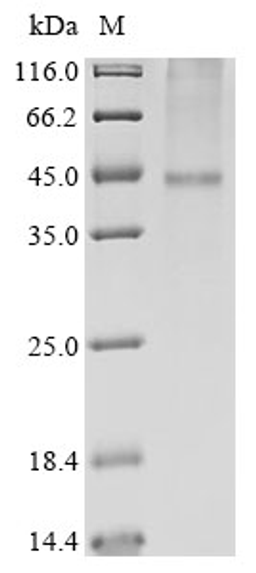 (Tris-Glycine gel) Discontinuous SDS-PAGE (reduced) with 5% enrichment gel and 15% separation gel.