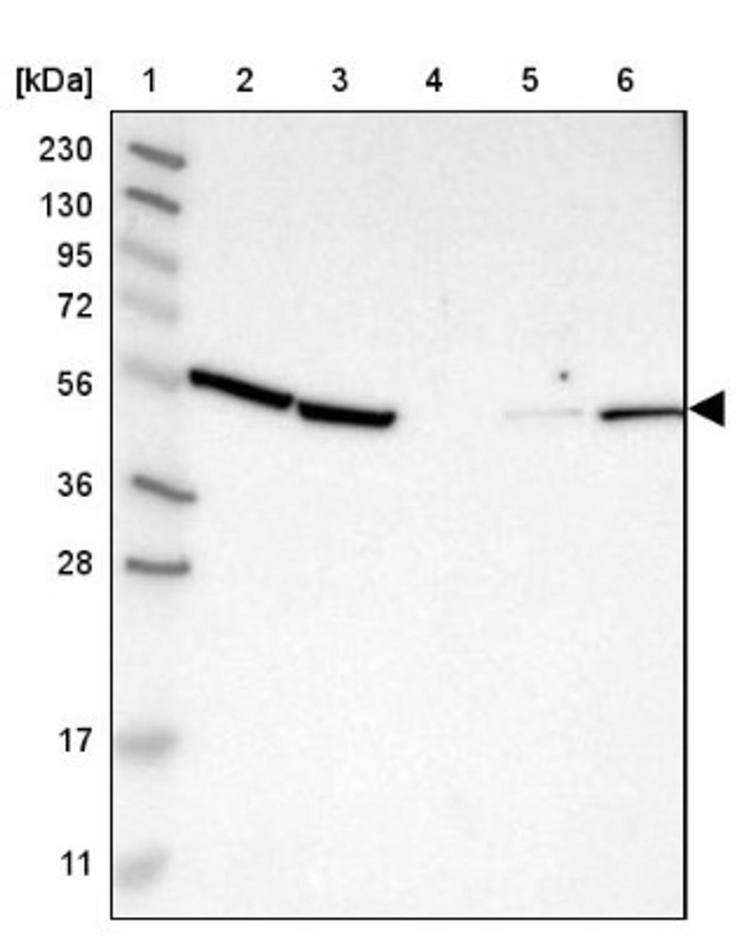 Western Blot: KLHDC1 Antibody [NBP1-82616] - Lane 1: Marker [kDa] 230, 130, 95, 72, 56, 36, 28, 17, 11<br/>Lane 2: Human cell line RT-4<br/>Lane 3: Human cell line U-251MG sp<br/>Lane 4: Human plasma (IgG/HSA depleted)<br/>Lane 5: Human liver tissue<br/>Lane 6: Human tonsil tissue