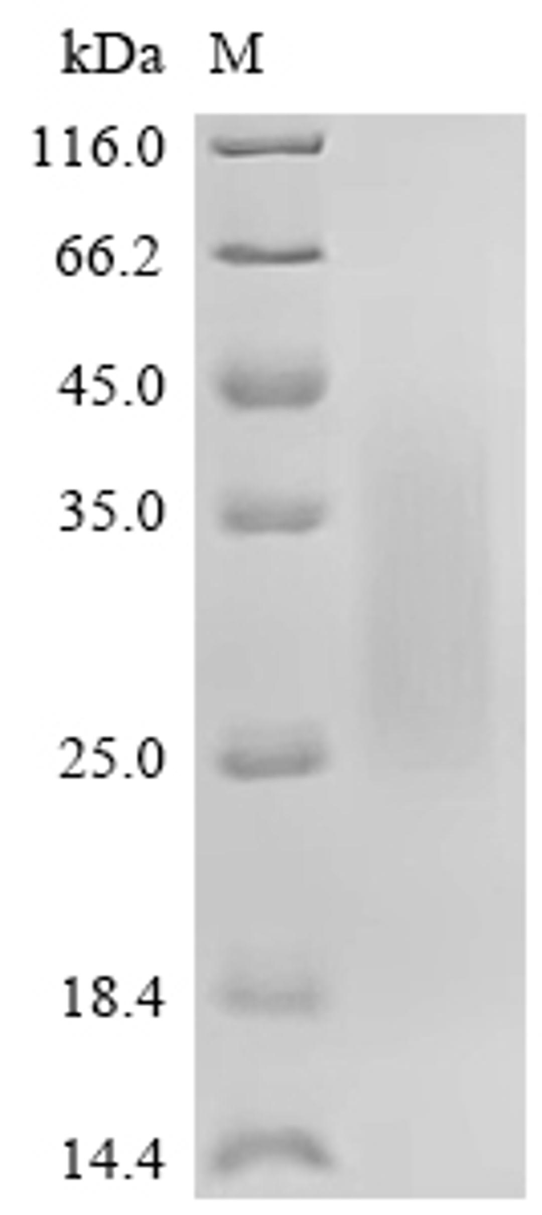 (Tris-Glycine gel) Discontinuous SDS-PAGE (reduced) with 5% enrichment gel and 15% separation gel.