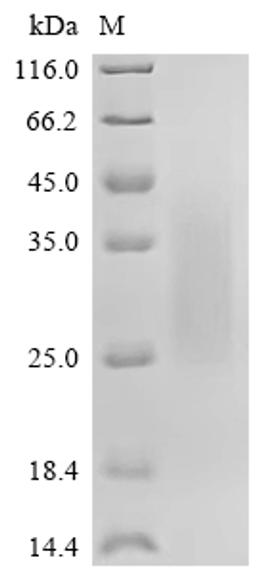 (Tris-Glycine gel) Discontinuous SDS-PAGE (reduced) with 5% enrichment gel and 15% separation gel.