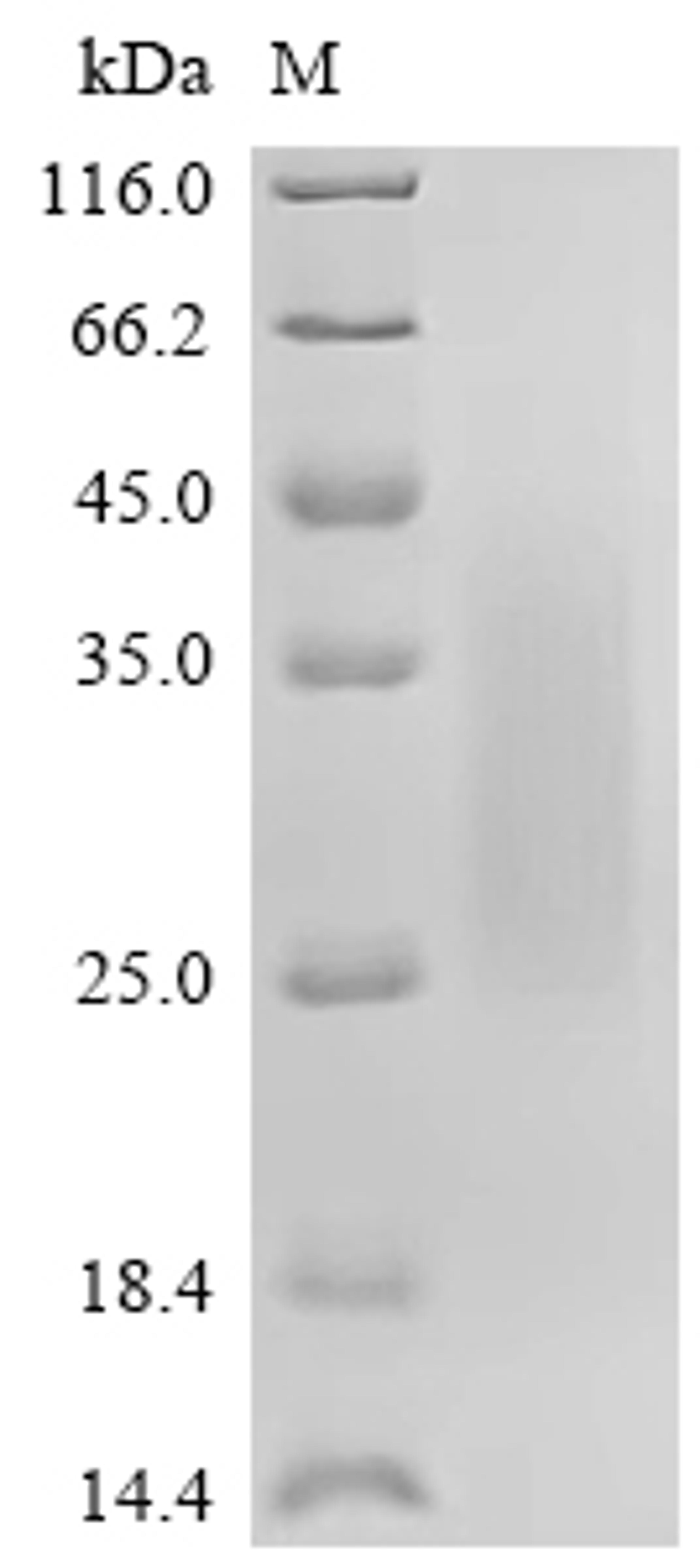(Tris-Glycine gel) Discontinuous SDS-PAGE (reduced) with 5% enrichment gel and 15% separation gel.