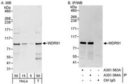 Detection of human WDR91 by western blot and immunoprecipitation.