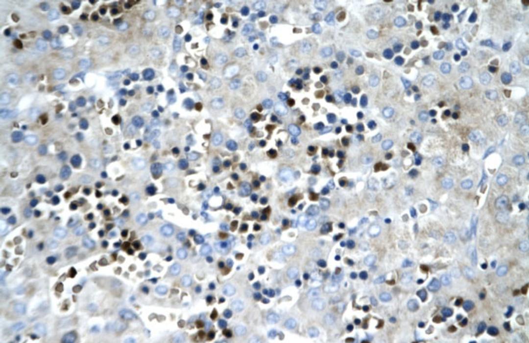 Antibody used in IHC on Human Liver.