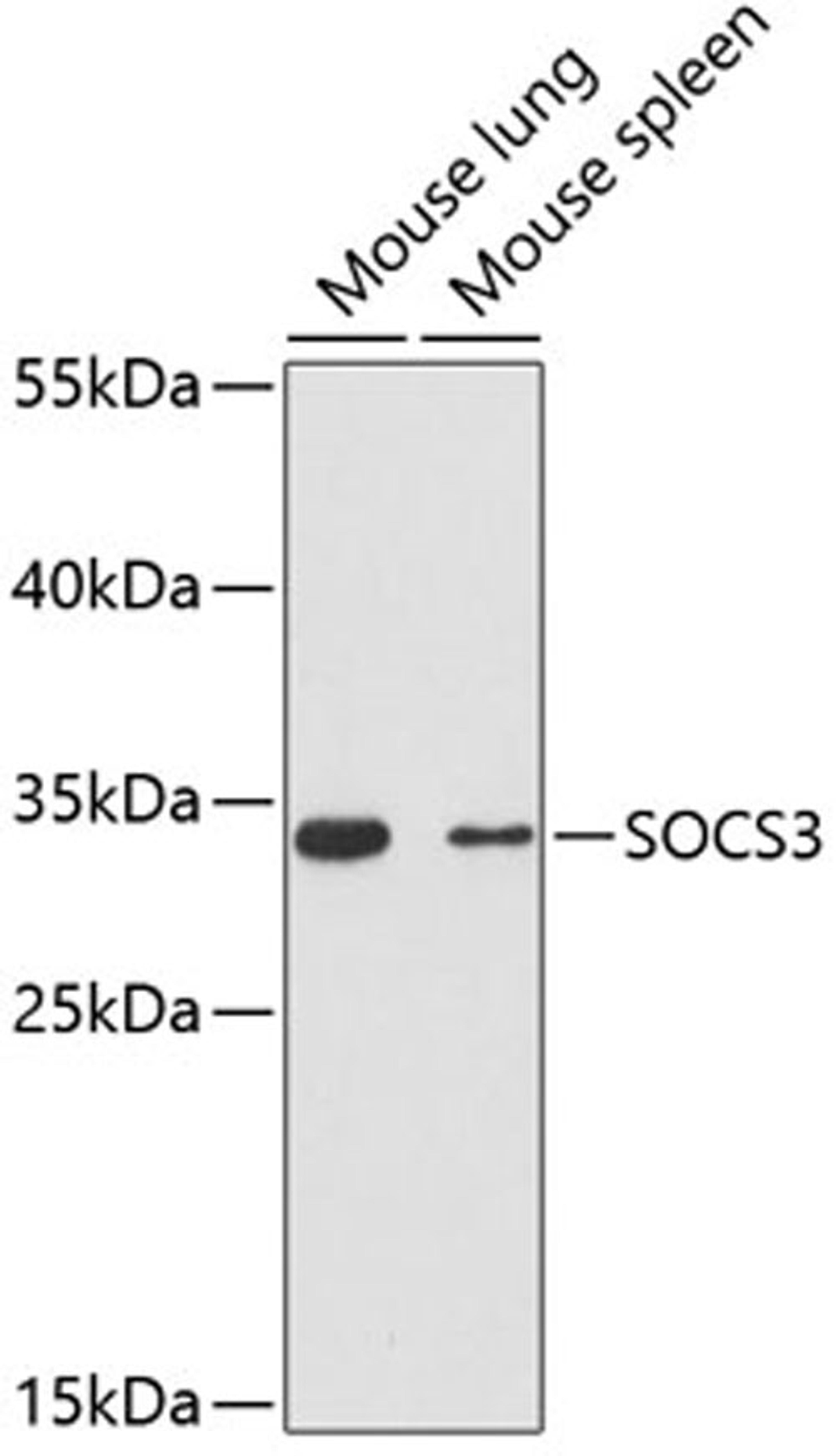 Western blot - SOCS3 antibody (A0769)