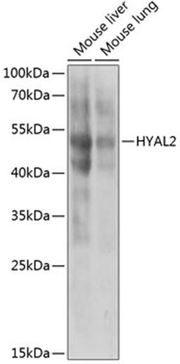 Western blot - HYAL2 antibody (A6624)