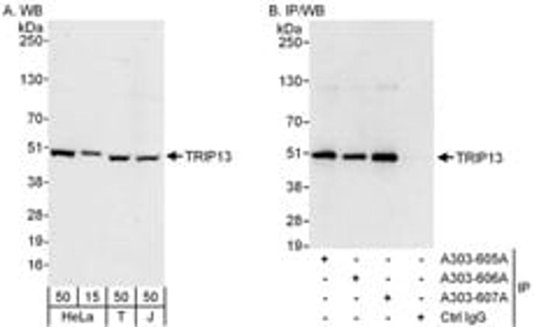 Detection of human TRIP13 by western blot and immunoprecipitation.