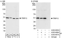 Detection of human TRIP13 by western blot and immunoprecipitation.