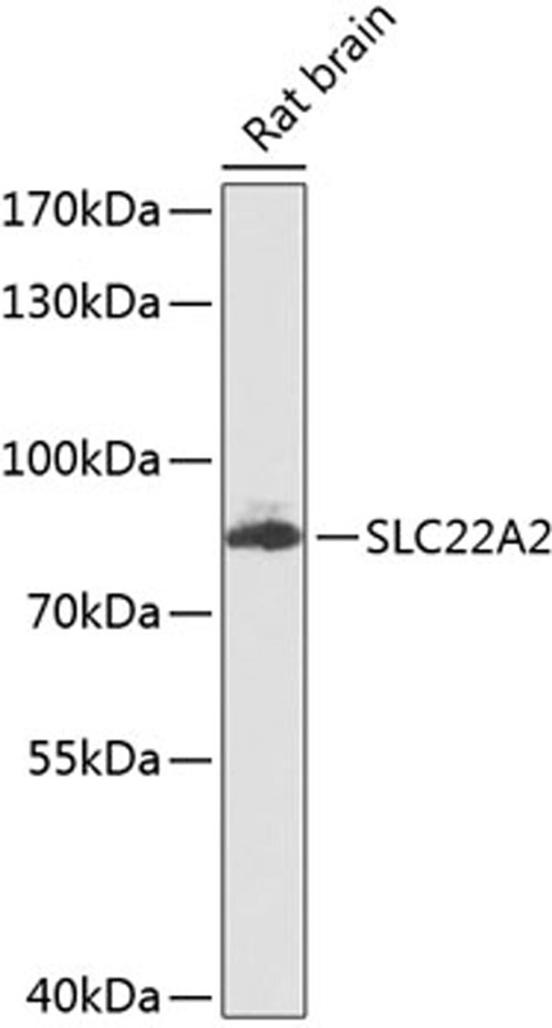 Western blot - SLC22A2 antibody (A8453)