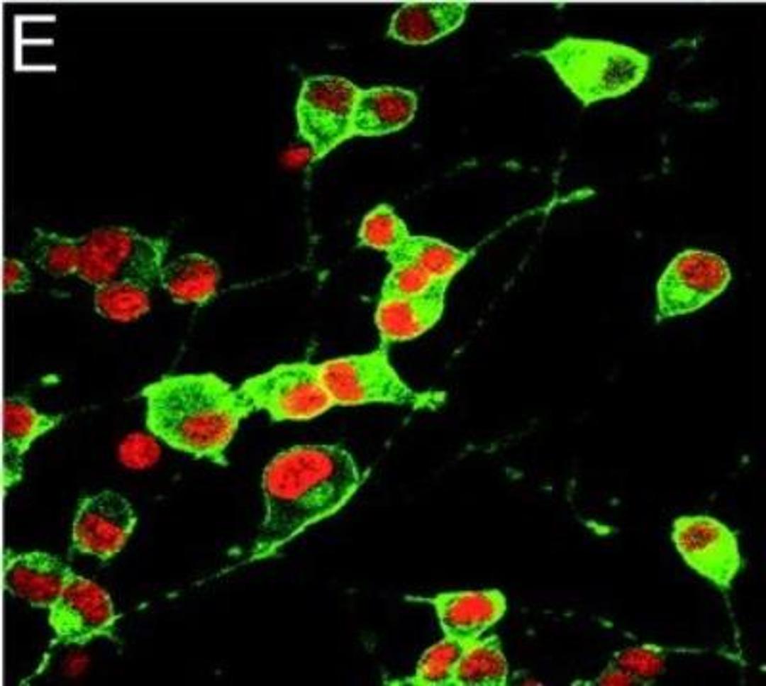 Immunocytochemistry/Immunofluorescence: GAP-43 Antibody [NB300-143] - Immunofluorescence of GAP-43 (green), a molecular marker of neurite outgrowth, demonstrates intense staining in overexpressing wild-type PS-1 (E) PC-12 cells. (Teo, et al, 2005)