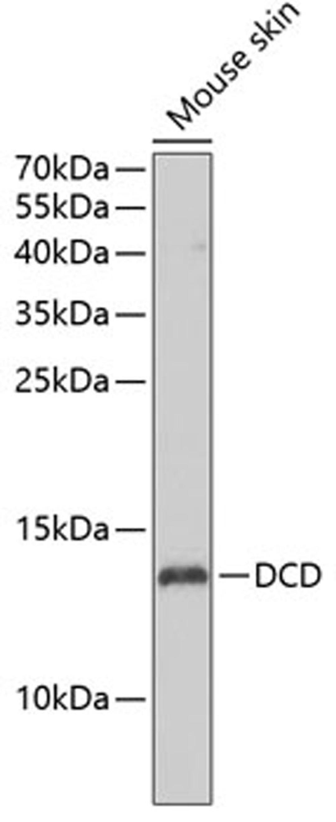 Western blot - DCD antibody (A7280)