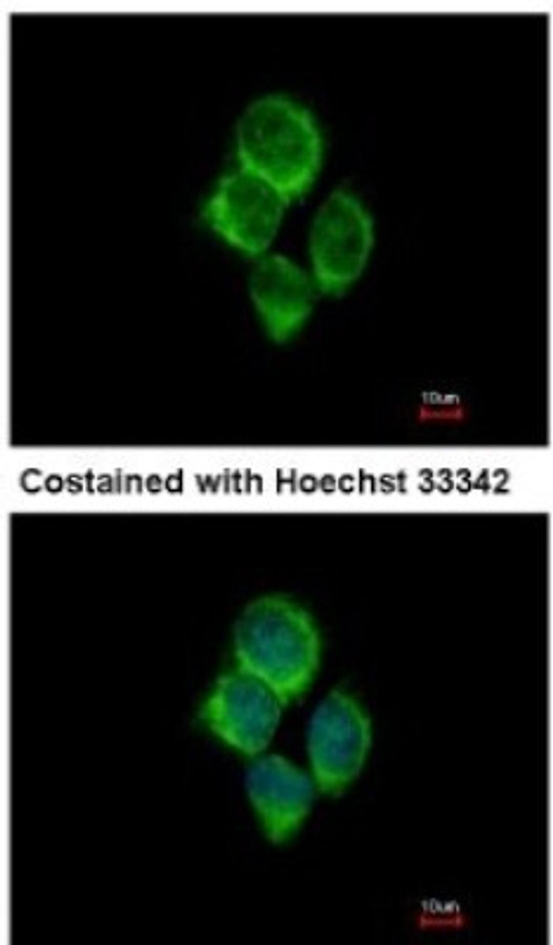 Immunocytochemistry/Immunofluorescence: solute carrier family 22, member 18 antisense Antibody [NBP2-15120] - Analysis of methanol-fixed A431, using antibody at 1:500 dilution.