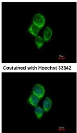 Immunocytochemistry/Immunofluorescence: solute carrier family 22, member 18 antisense Antibody [NBP2-15120] - Analysis of methanol-fixed A431, using antibody at 1:500 dilution.