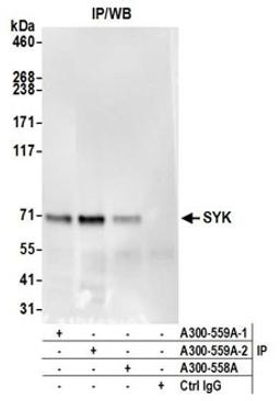 Detection of human SYK by western blot of immunoprecipitates.