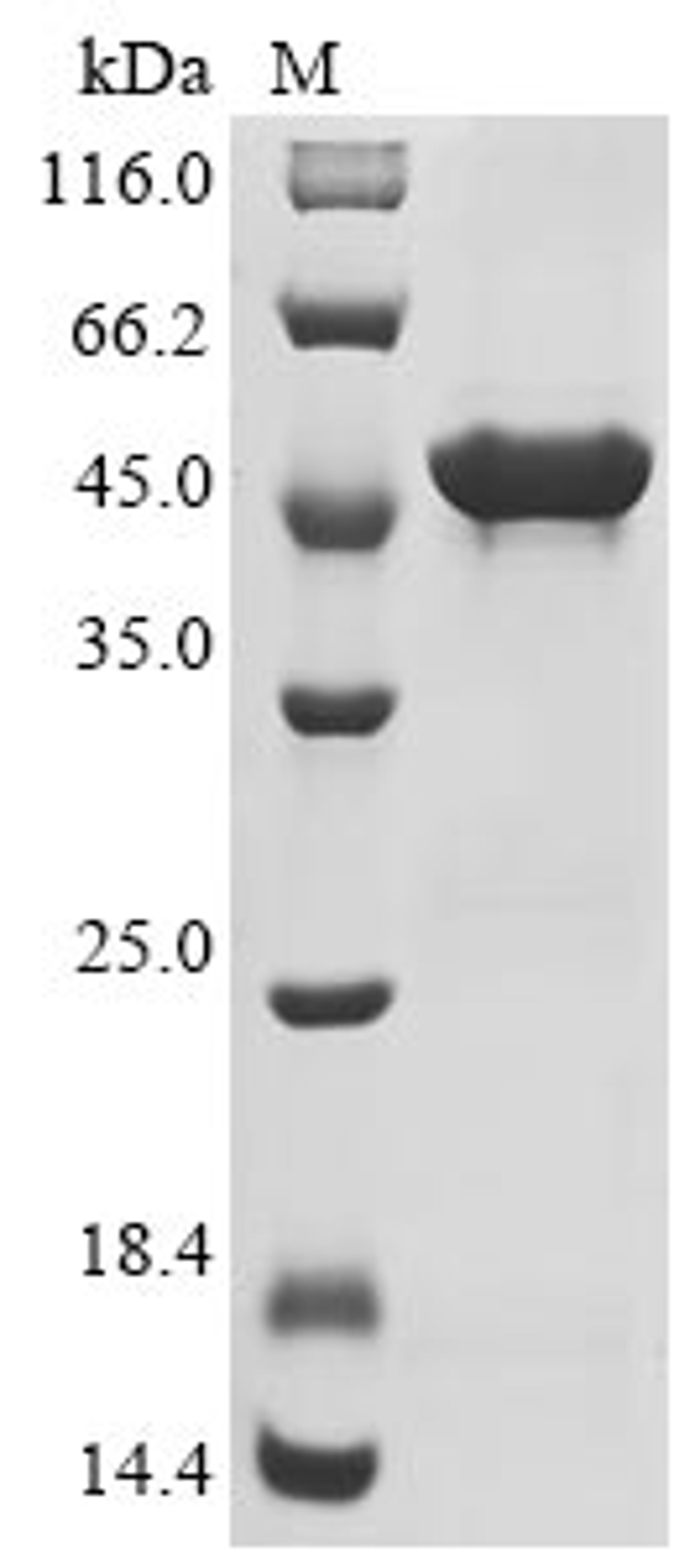 (Tris-Glycine gel) Discontinuous SDS-PAGE (reduced) with 5% enrichment gel and 15% separation gel.
