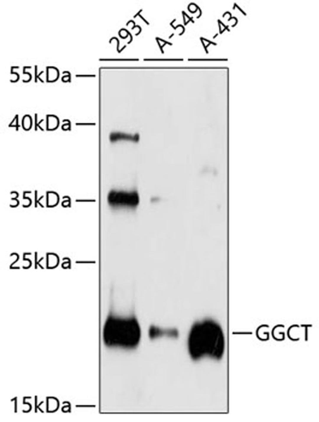 Western blot - GGCT antibody (A4957)