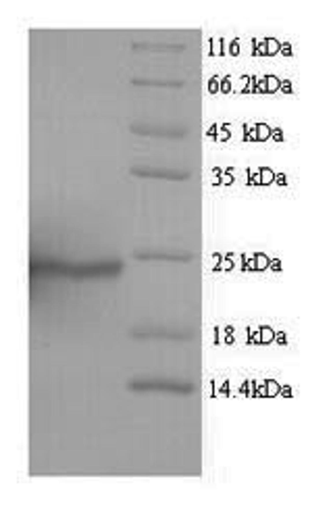 (Tris-Glycine gel) Discontinuous SDS-PAGE (reduced) with 5% enrichment gel and 15% separation gel.
