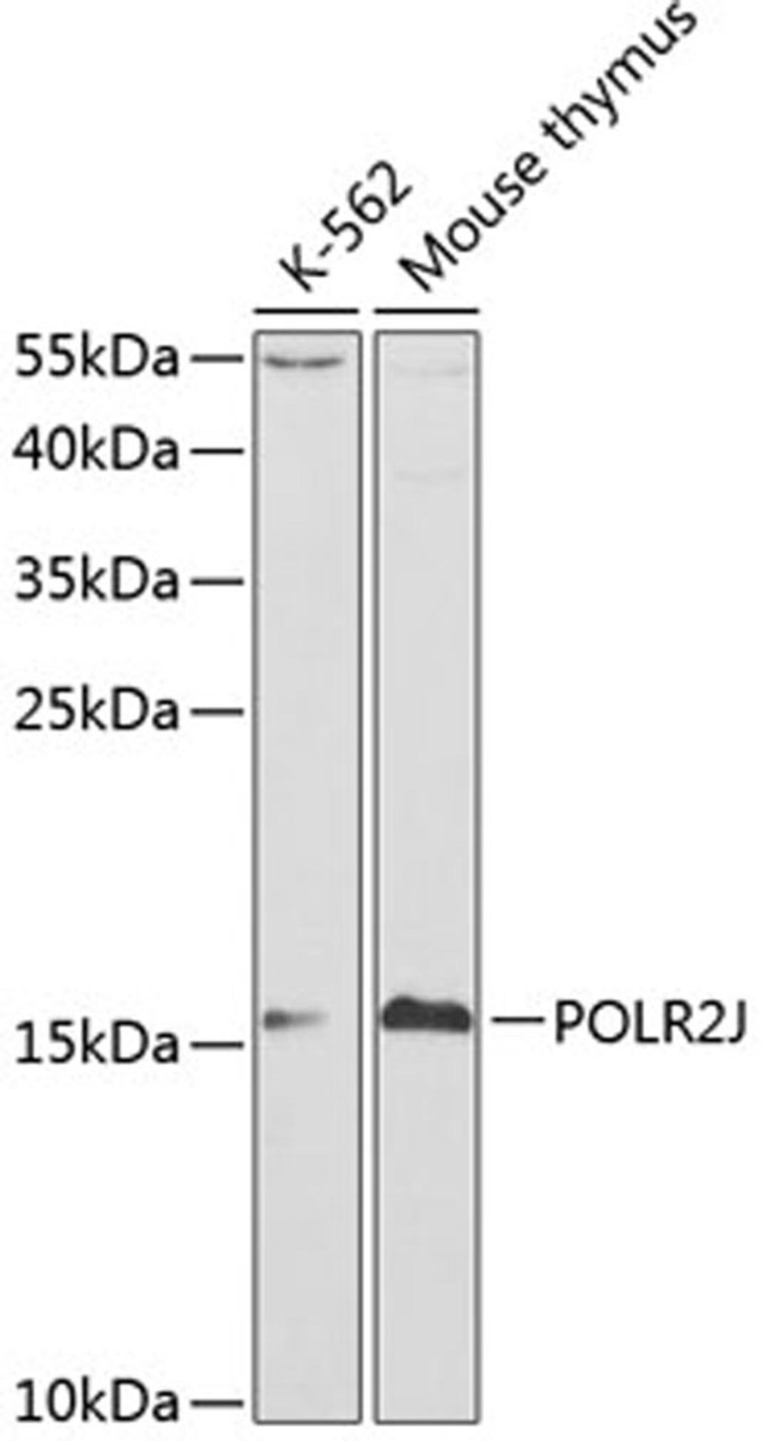 Western blot - POLR2J antibody (A1843)