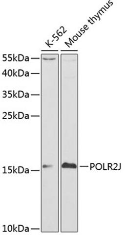 Western blot - POLR2J antibody (A1843)