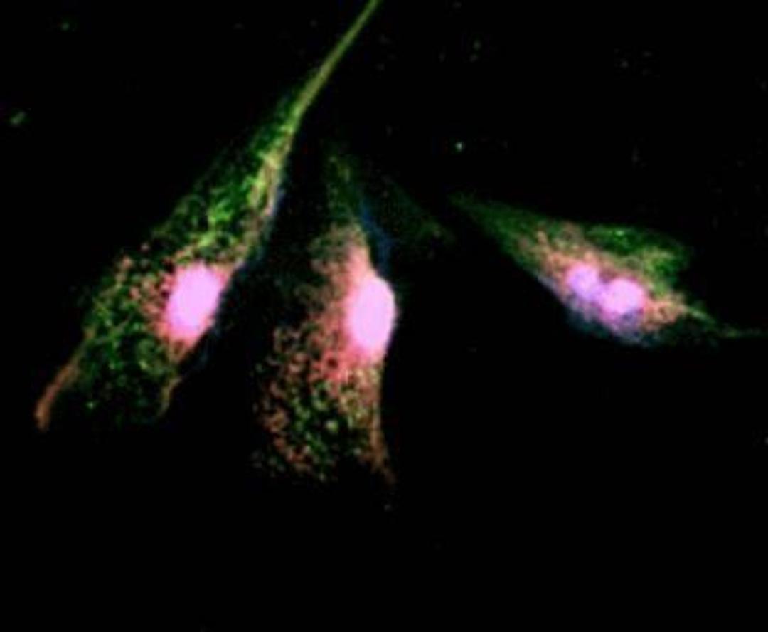 Immunocytochemistry/Immunofluorescence: P2X3/P2RX3 Antibody [NB100-1654] - Double immunofluorescence staining in cultured human bladder urothelial cells (BUCs). BUCs show cytokeratin (red areas) and P2X3 (green areas) expression.