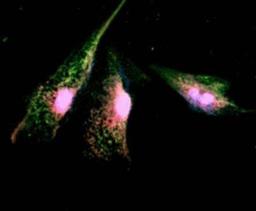 Immunocytochemistry/Immunofluorescence: P2X3/P2RX3 Antibody [NB100-1654] - Double immunofluorescence staining in cultured human bladder urothelial cells (BUCs). BUCs show cytokeratin (red areas) and P2X3 (green areas) expression.