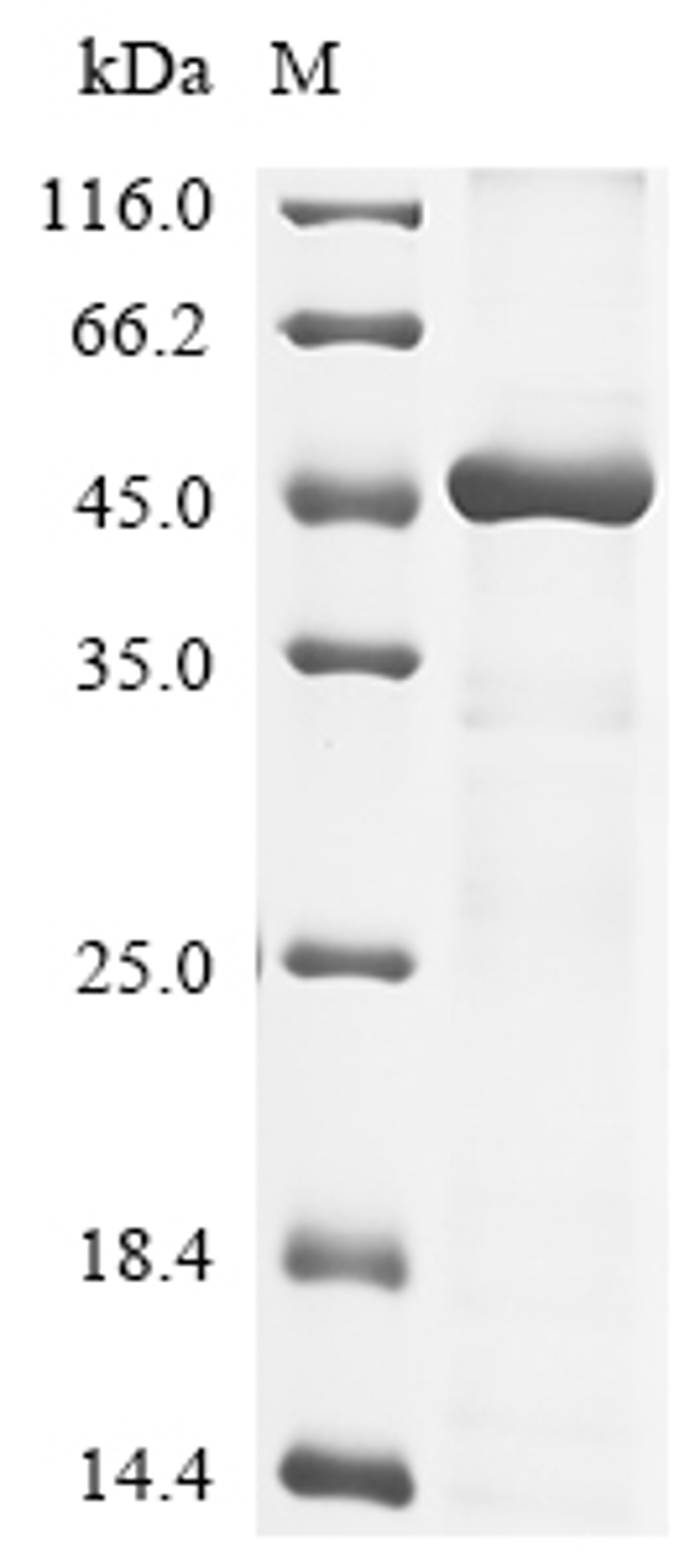 (Tris-Glycine gel) Discontinuous SDS-PAGE (reduced) with 5% enrichment gel and 15% separation gel.