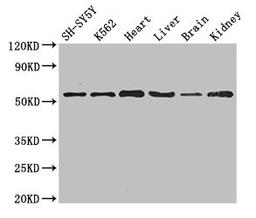 Western Blot. Positive WB detected in: SH-SY5Y whole cell lysate, K562 whole cell lysate, Mouse heart tissue, Mouse liver tissue, Mouse brain tissue, Mouse kidney tissue. All lanes: SLC16A9 antibody at 3.5ug/ml. Secondary. Goat polyclonal to rabbit IgG at 1/50000 dilution. Predicted band size: 56 kDa. Observed band size: 56 kDa.