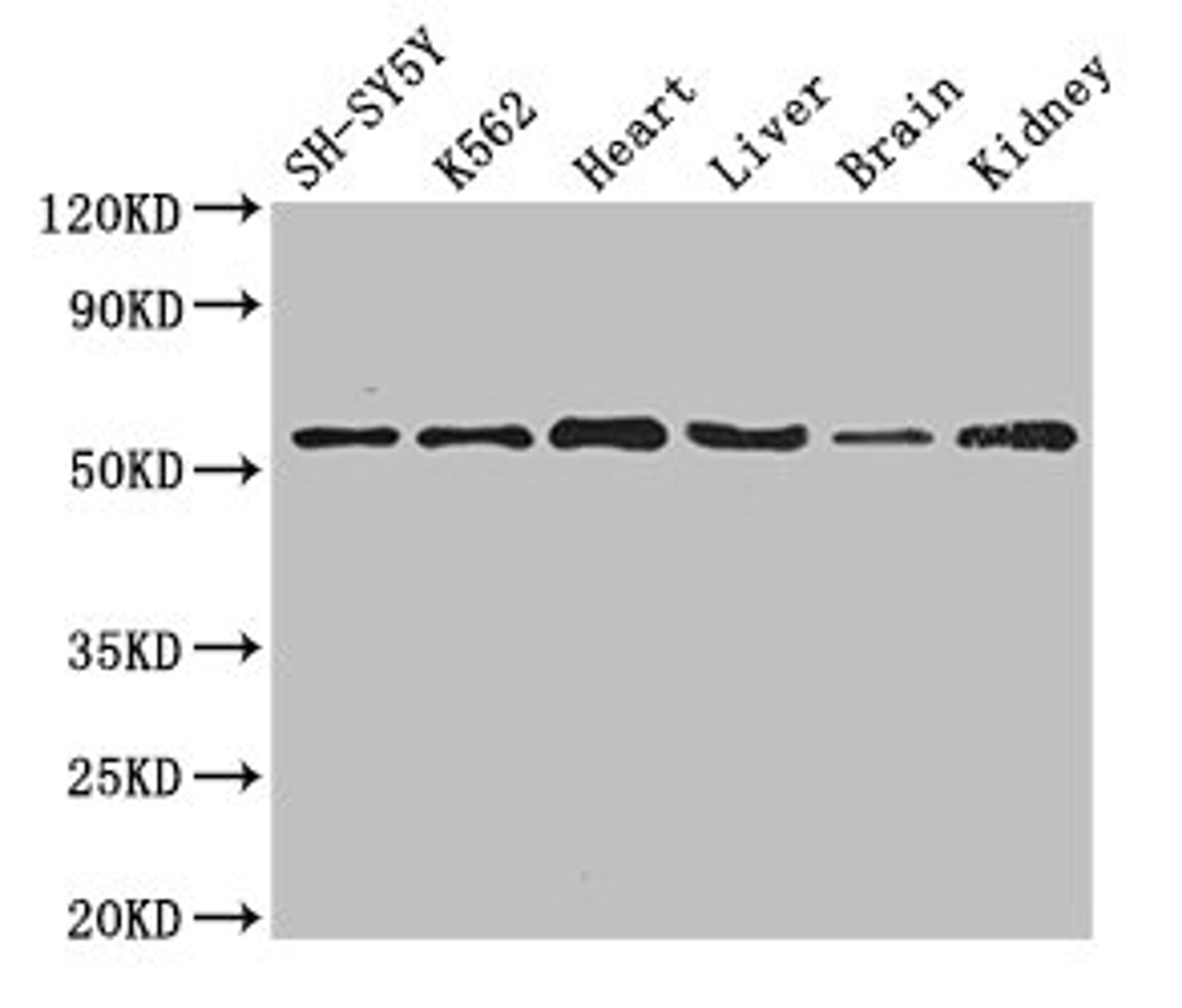 Western Blot. Positive WB detected in: SH-SY5Y whole cell lysate, K562 whole cell lysate, Mouse heart tissue, Mouse liver tissue, Mouse brain tissue, Mouse kidney tissue. All lanes: SLC16A9 antibody at 3.5ug/ml. Secondary. Goat polyclonal to rabbit IgG at 1/50000 dilution. Predicted band size: 56 kDa. Observed band size: 56 kDa.