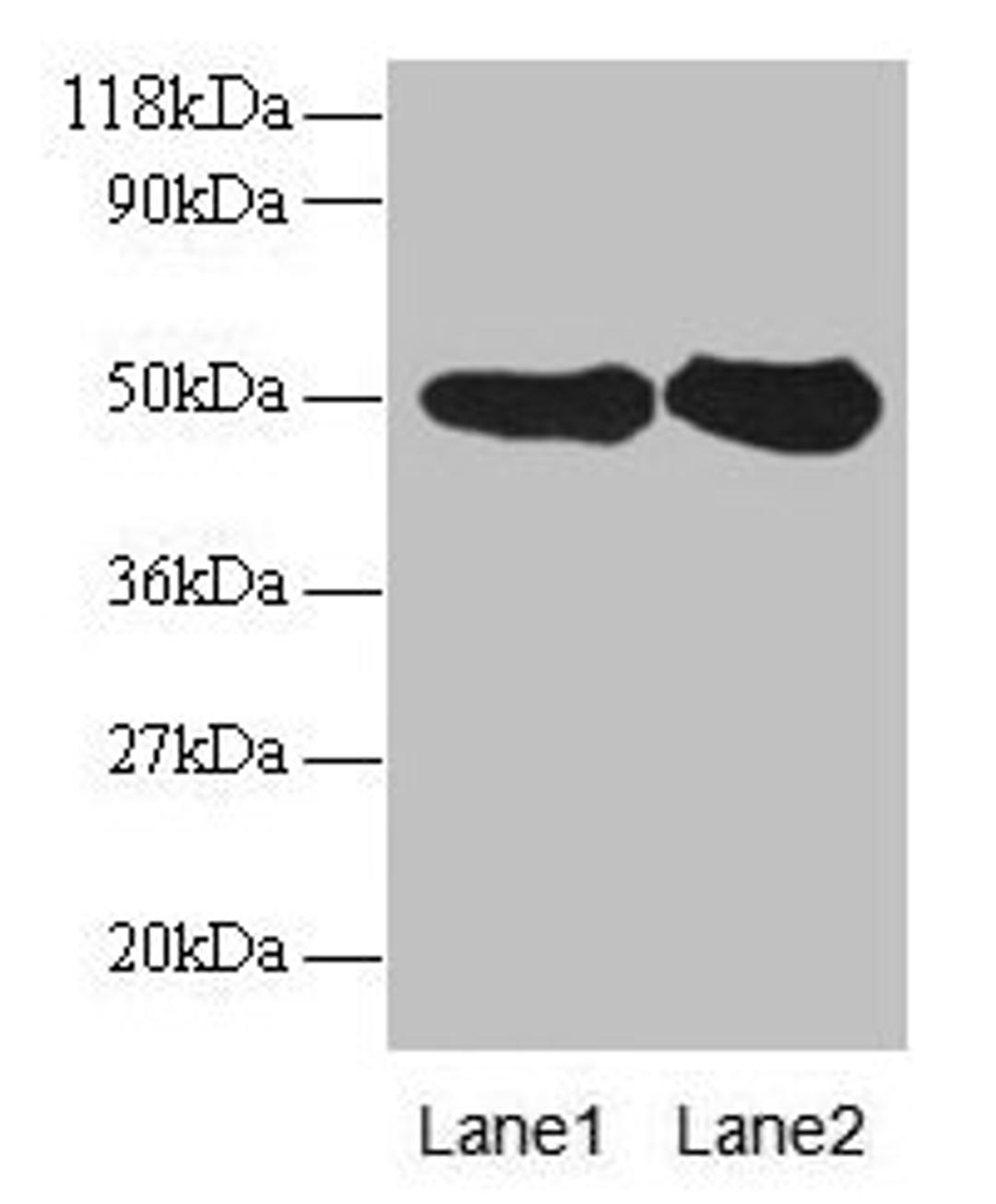 Western blot. All lanes: RPN1 antibody at 2µg/ml. Lane 1: EC109 whole cell lysate. Lane 2: 293T whole cell lysate. Secondary. Goat polyclonal to rabbit IgG at 1/15000 dilution. Predicted band size: 50 kDa. Observed band size: 50 kDa
