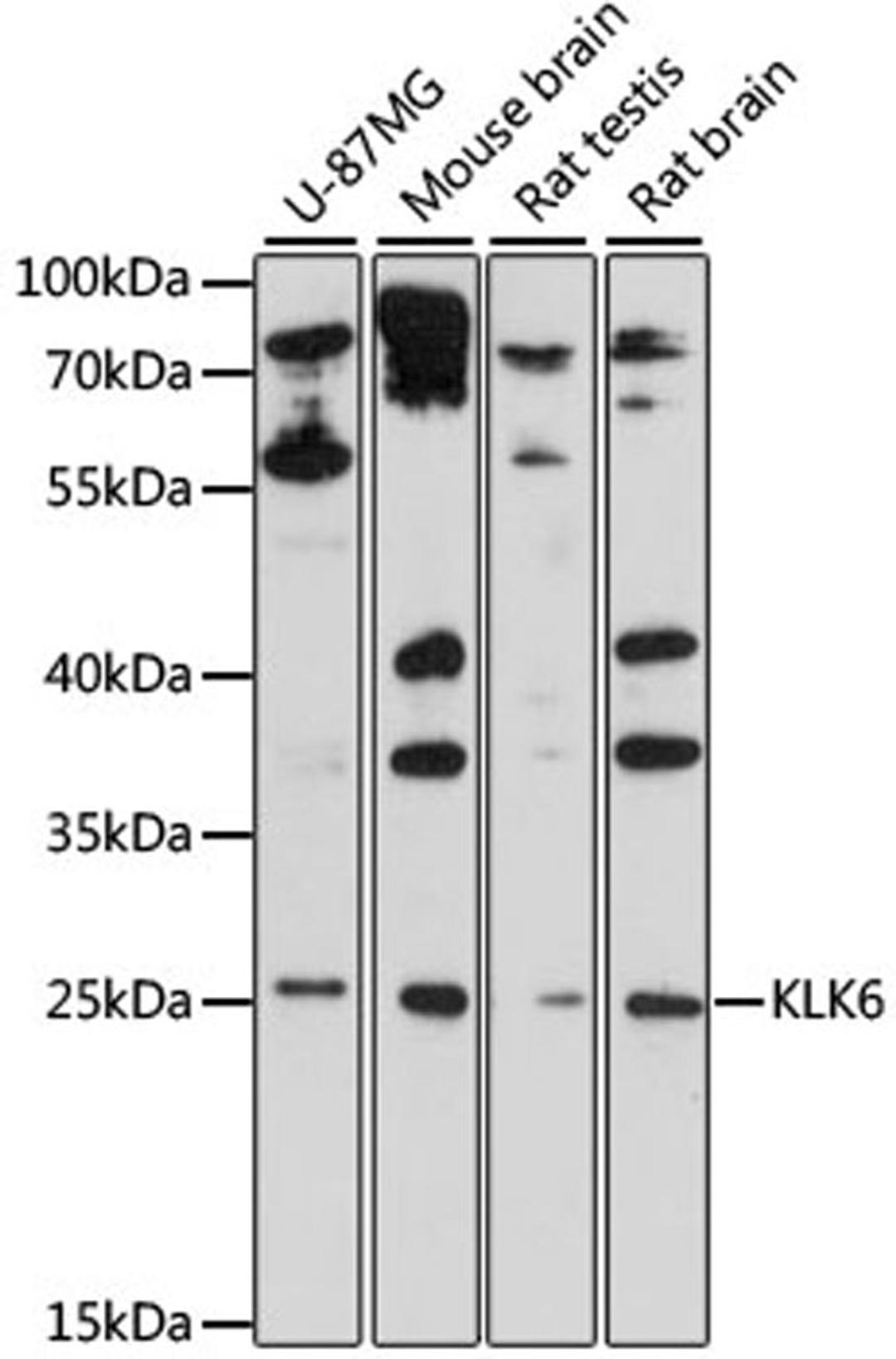 Western blot - KLK6 antibody (A11972)