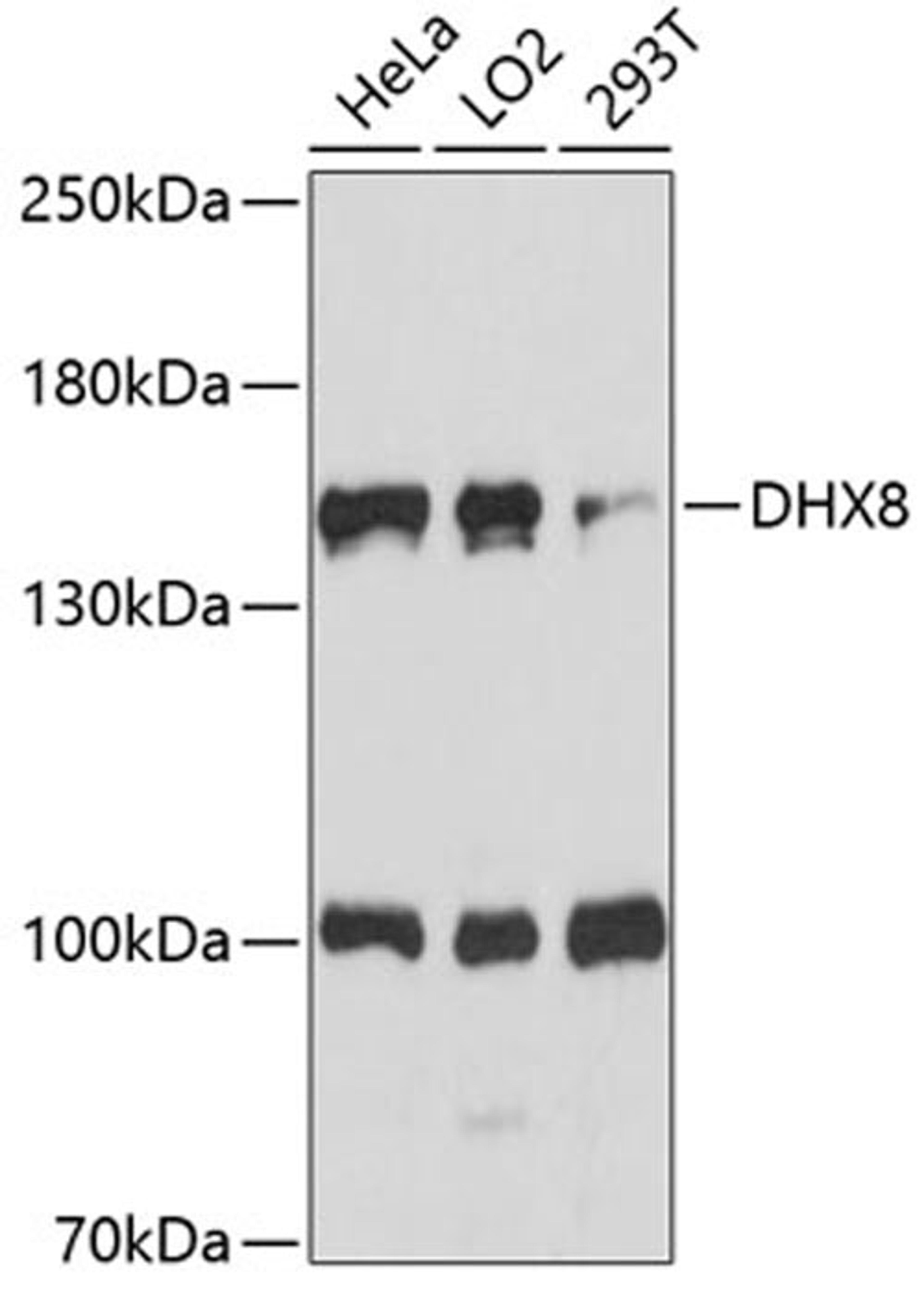 Western blot - DHX8 antibody (A14724)