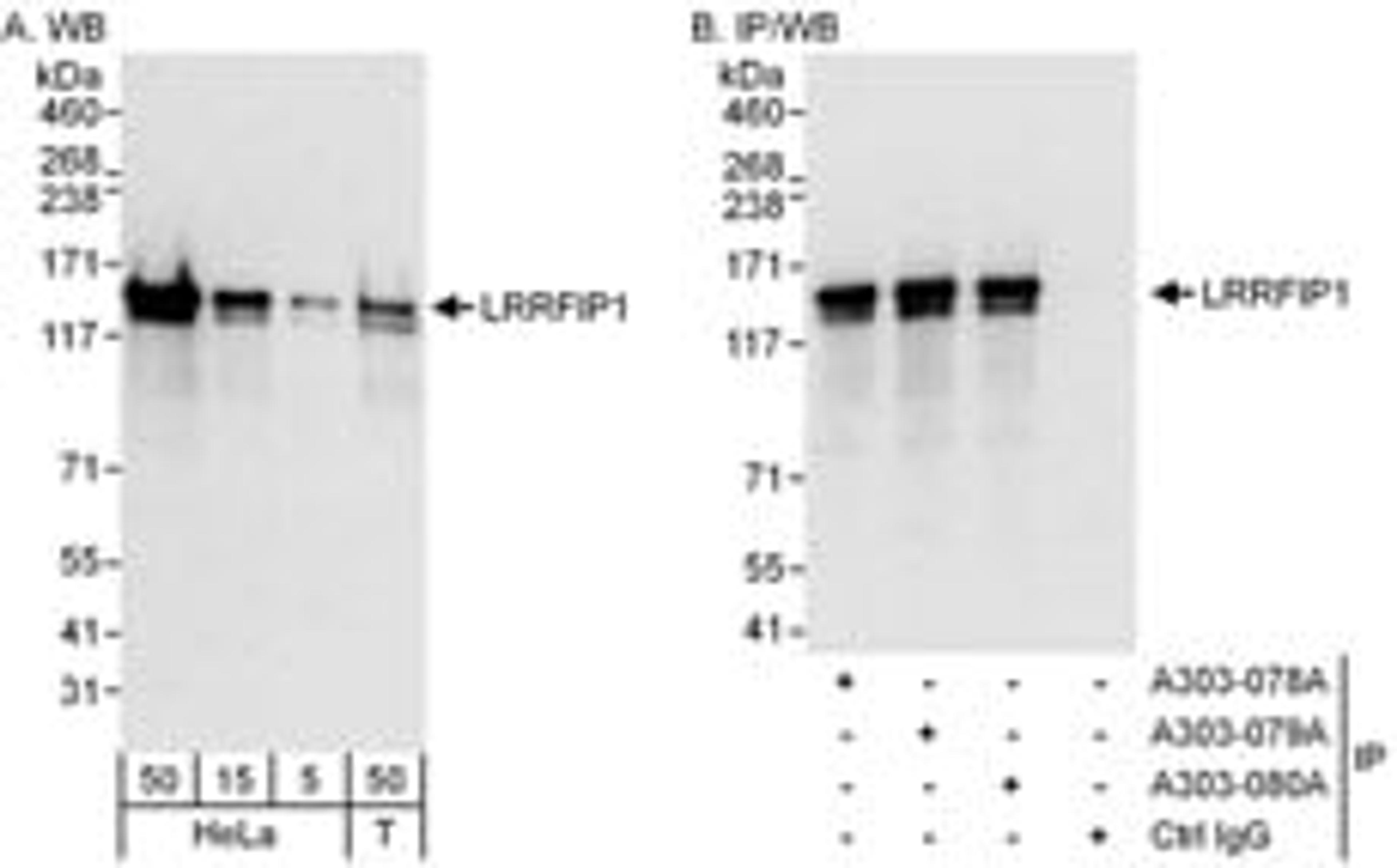 Detection of human LRRFIP1 by western blot and immunoprecipitation.