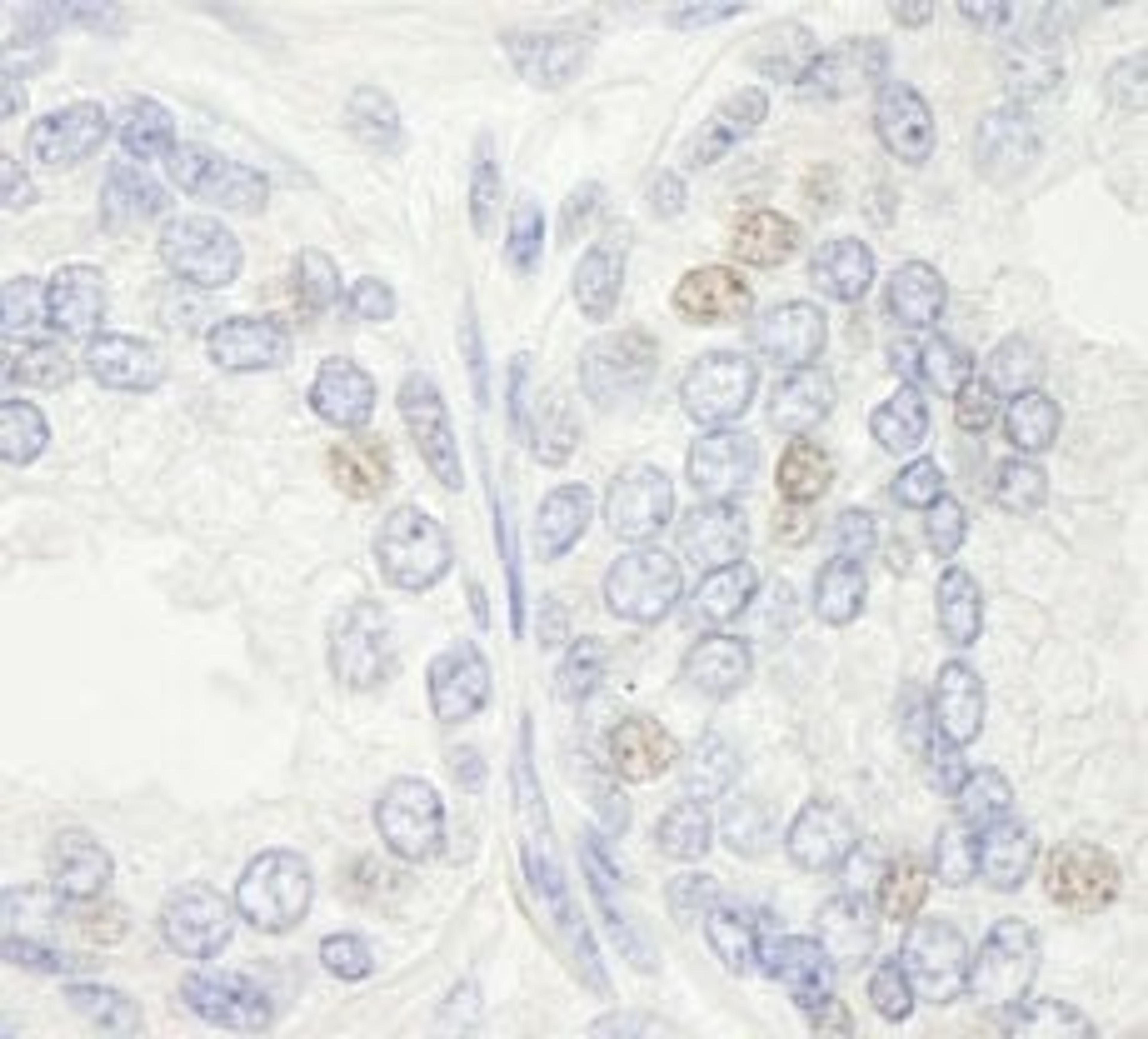 Detection of human XPF/ERCC4 by immunohistochemistry.