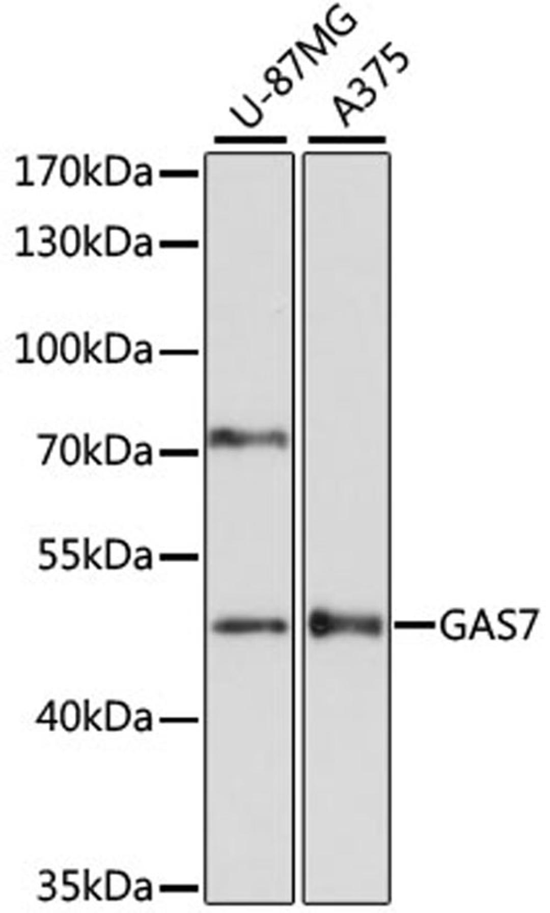 Western blot - GAS7 antibody (A14179)