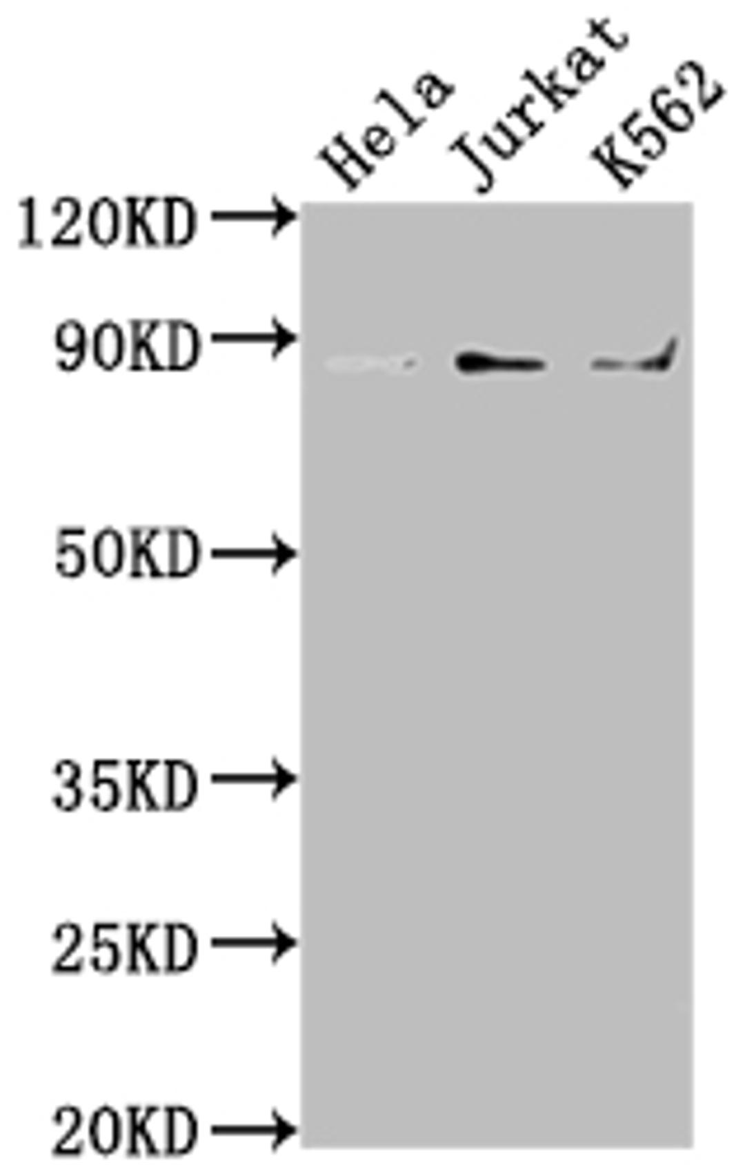 Western Blot. Positive WB detected in: Hela whole cell lysate, Jurkat whole cell lysate, K562 whole cell lysate. All lanes: IKBKB antibody at 1:2000. Secondary. Goat polyclonal to rabbit IgG at 1/50000 dilution. Predicted band size: 87, 86, 30, 80 kDa. Observed band size: 87 kDa.