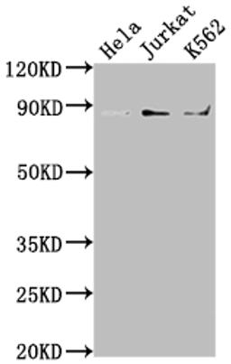 Western Blot. Positive WB detected in: Hela whole cell lysate, Jurkat whole cell lysate, K562 whole cell lysate. All lanes: IKBKB antibody at 1:2000. Secondary. Goat polyclonal to rabbit IgG at 1/50000 dilution. Predicted band size: 87, 86, 30, 80 kDa. Observed band size: 87 kDa.