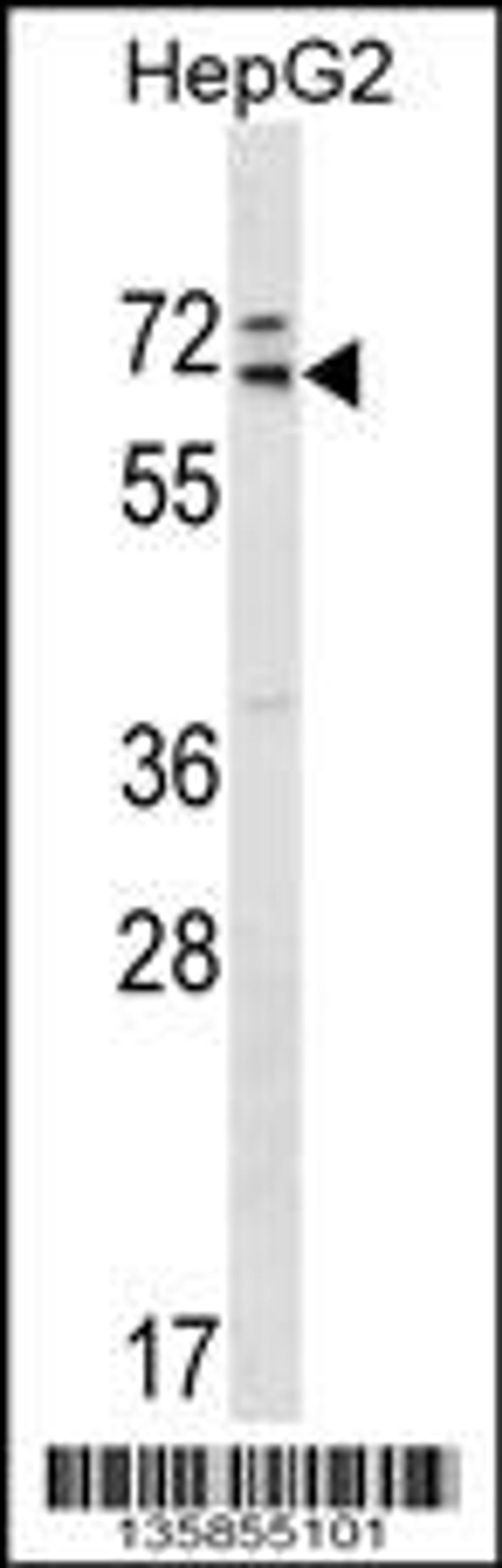 Western blot analysis in HepG2 cell line lysates (35ug/lane).