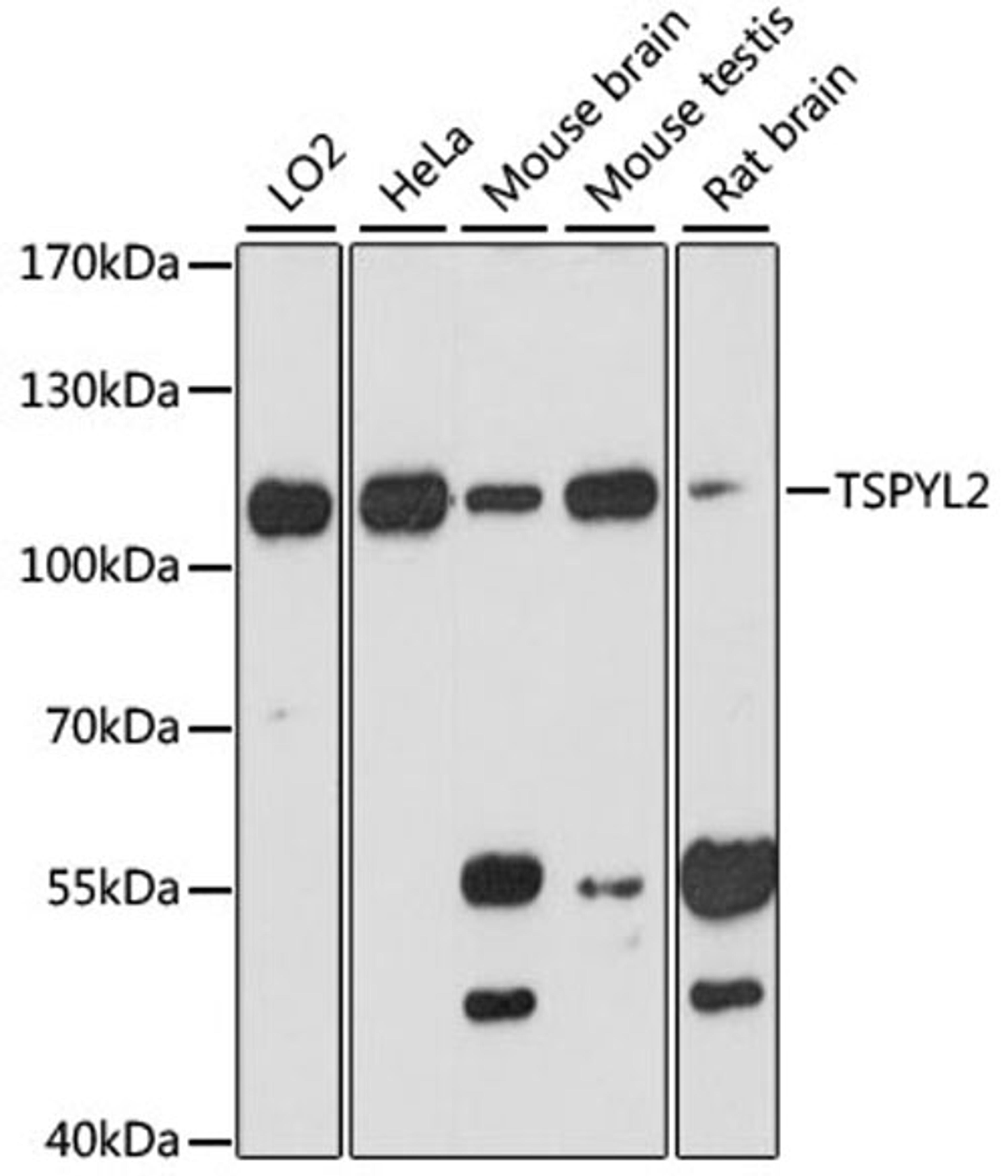 Western blot - TSPYL2 antibody (A13118)