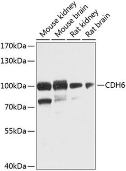 Western blot - CDH6 antibody (A8109)