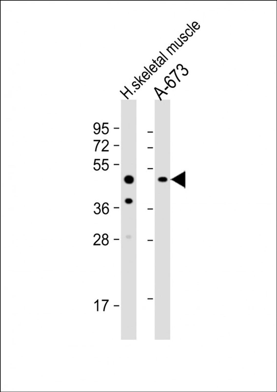 Western Blot at 1:1000 dilution Lane 1: human skeletal muscle lysate Lane 2: A-673 whole cell lysate Lysates/proteins at 20 ug per lane.