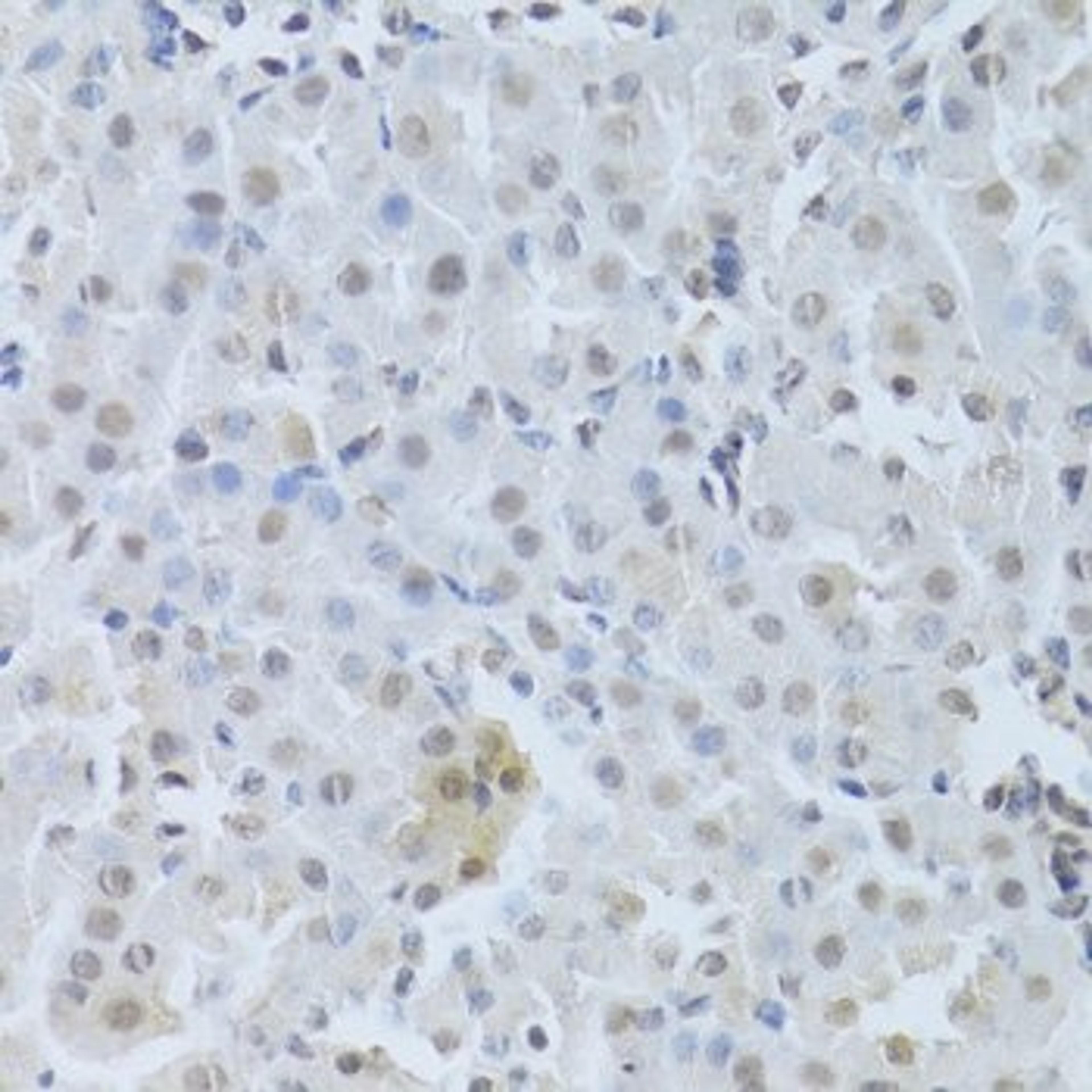 Immunohistochemistry of paraffin-embedded mouse kidney using CDK4 antibody