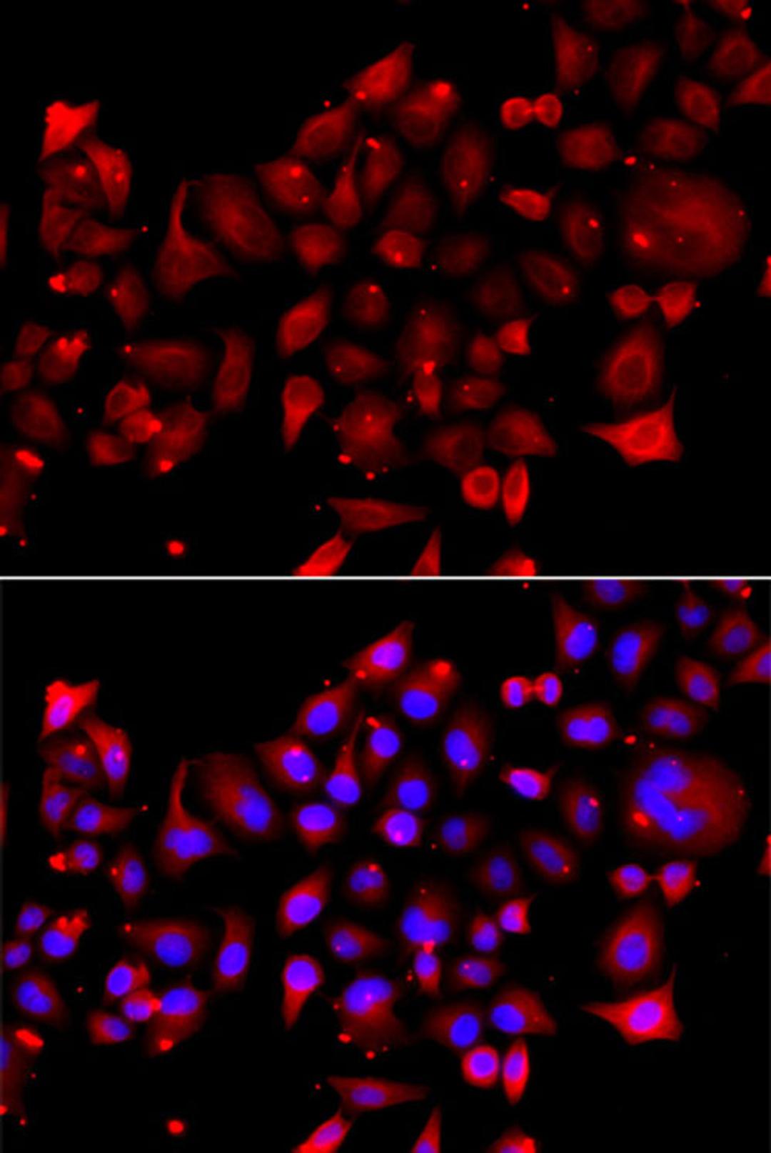 Immunofluorescence - RRM2B antibody (A8020)