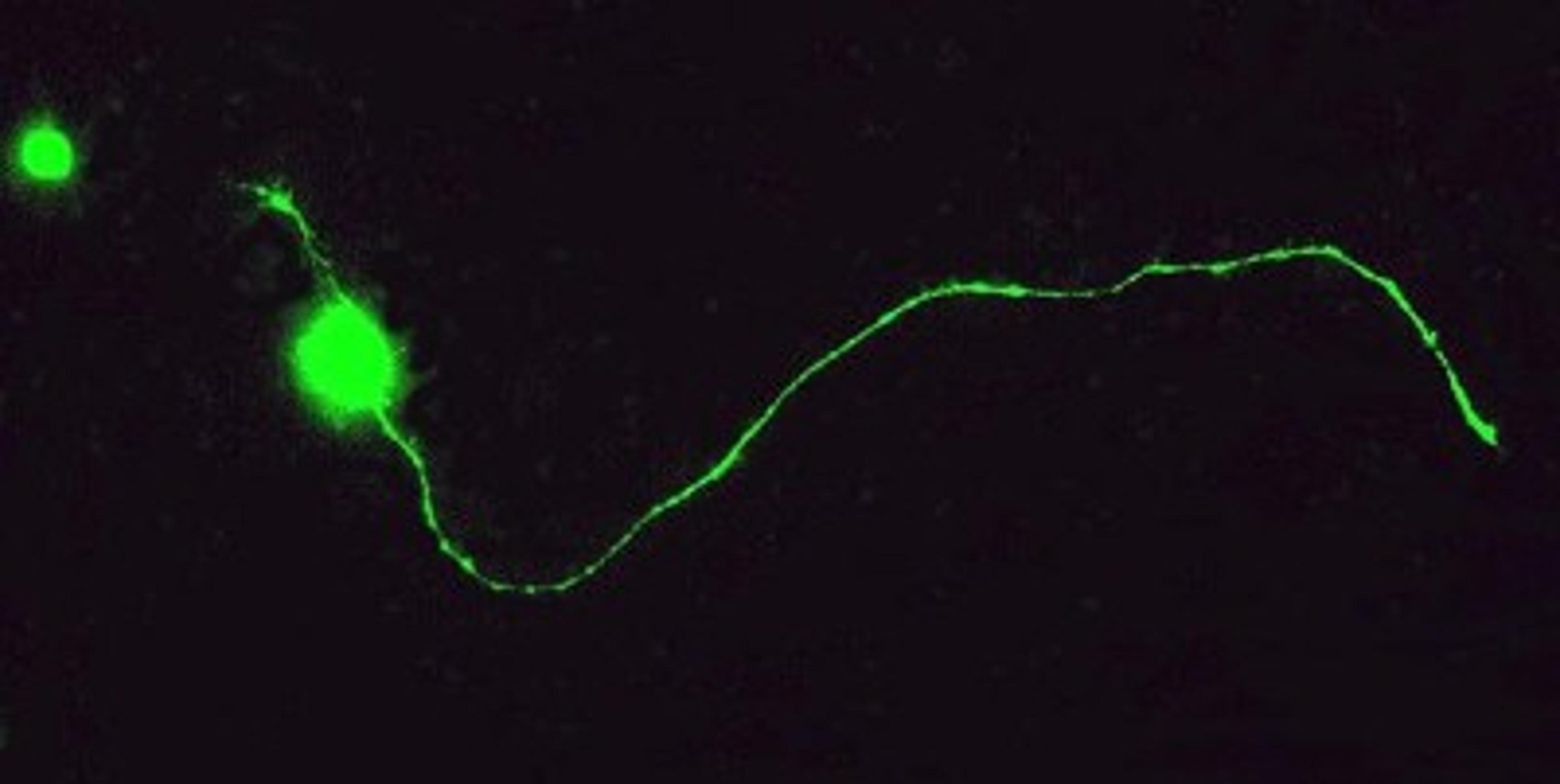 Immunocytochemistry/Immunofluorescence: GAP43 Antibody [NBP1-41123] - Staining of a mature retinal ganglion cell demonstrating axon outgrowth.