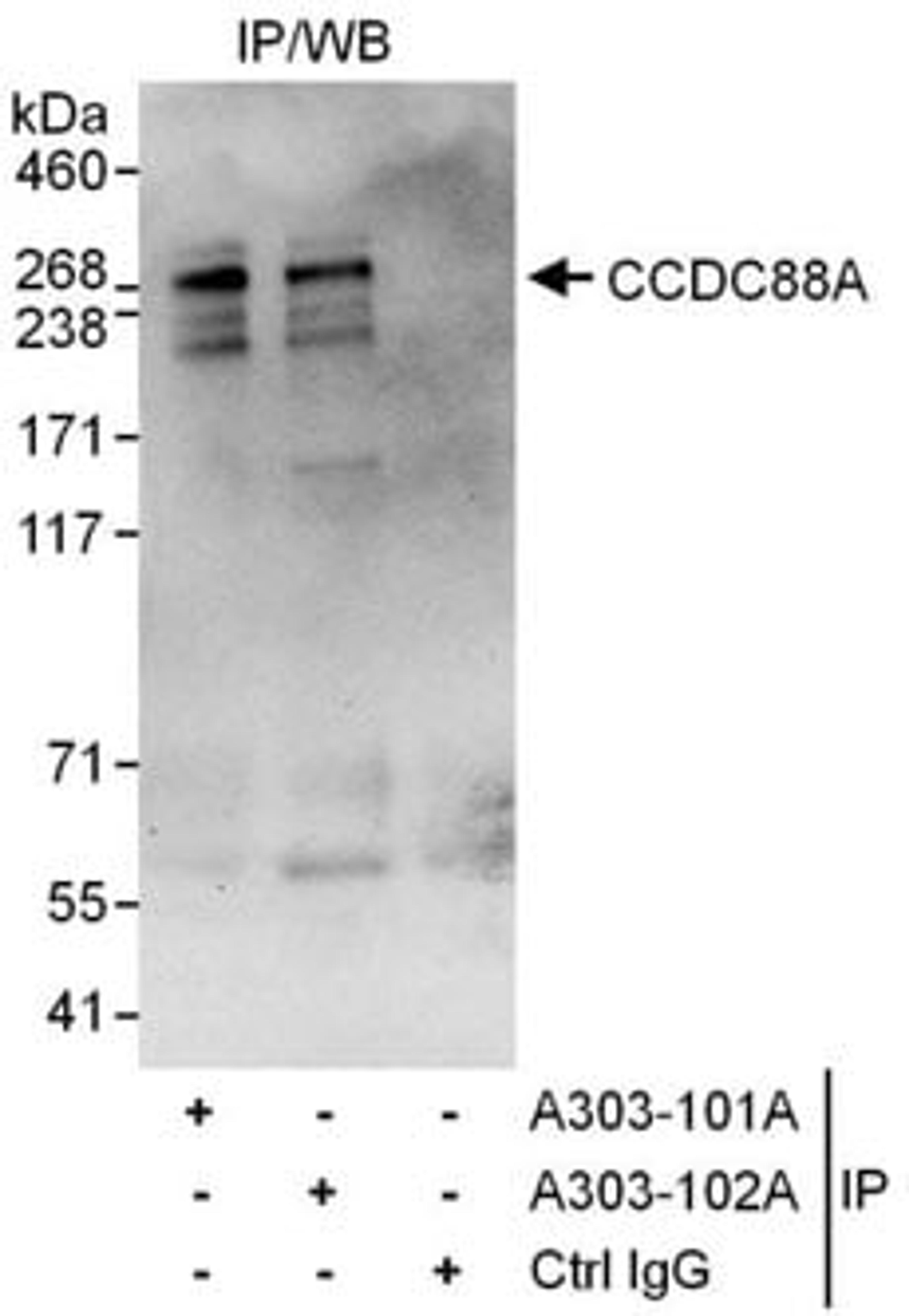 Detection of human CCDC88A by western blot of immunoprecipitates.