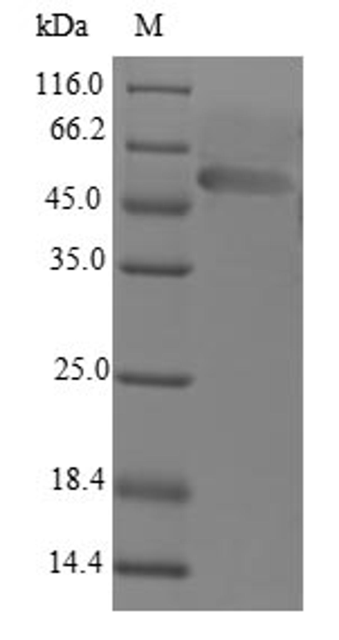 (Tris-Glycine gel) Discontinuous SDS-PAGE (reduced) with 5% enrichment gel and 15% separation gel.