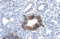 Antibody used in IHC on Human Lung at 4.0-8.0 ug/ml.