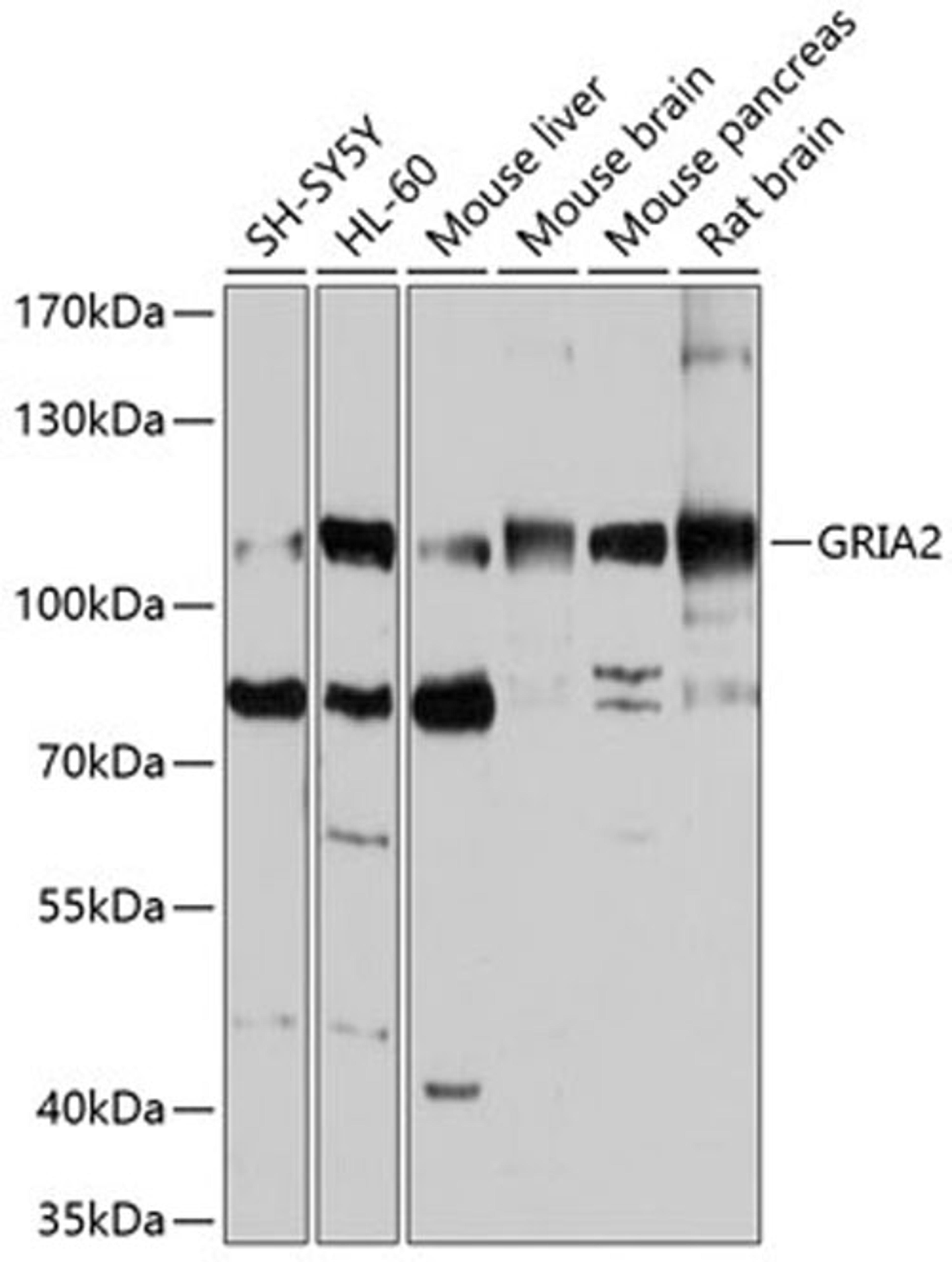 Western blot - GRIA2 antibody (A0111)