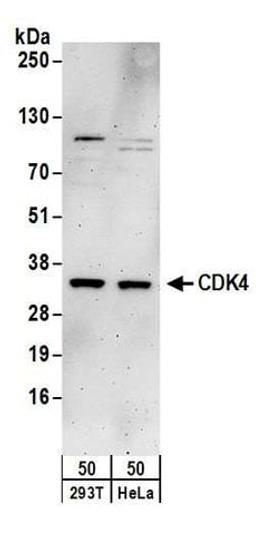 Detection of human CDK4 by western blot.