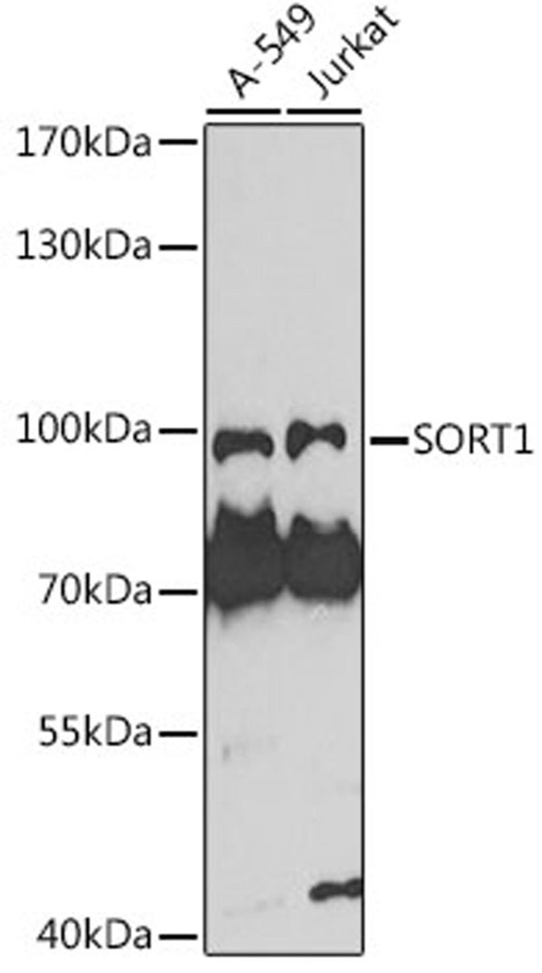 Western blot - SORT1 antibody (A7926)